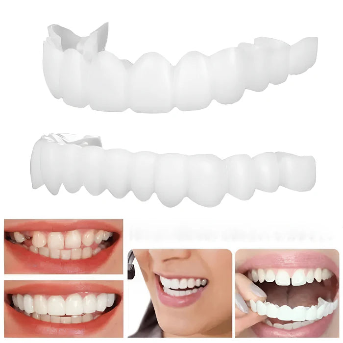 Facetas Dentales DentalLux | Sonrisa Perfecta Sin Dolor Ni Dentista